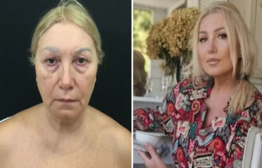 Пенсионерка помолодела на 30 лет