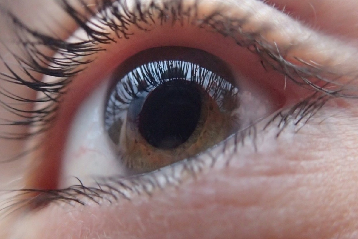 Ученые: Скрытые последствия COVID можно определить по роговице глаза