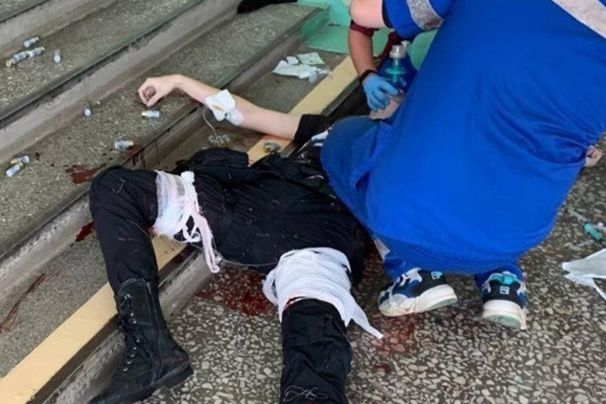 Студент, устроивший бойню в Перми, лишился ноги