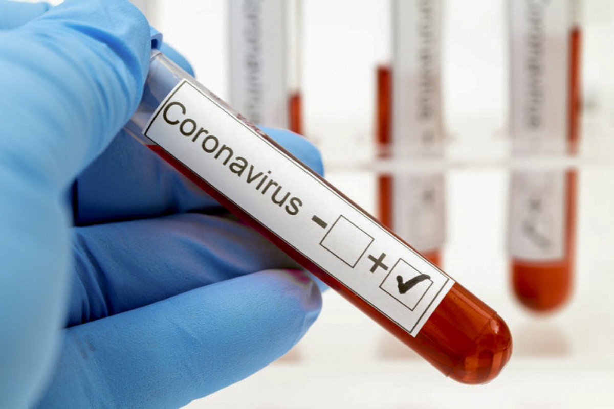 Обнародован процент заражения коронавирусом по регионам Азербайджана