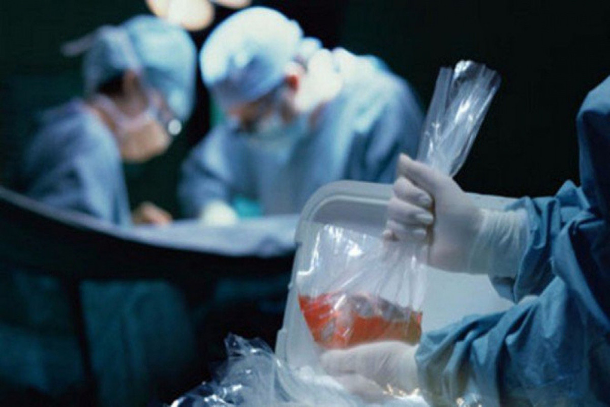 В Азербайджане создан Координационный центр по трансплантации органов