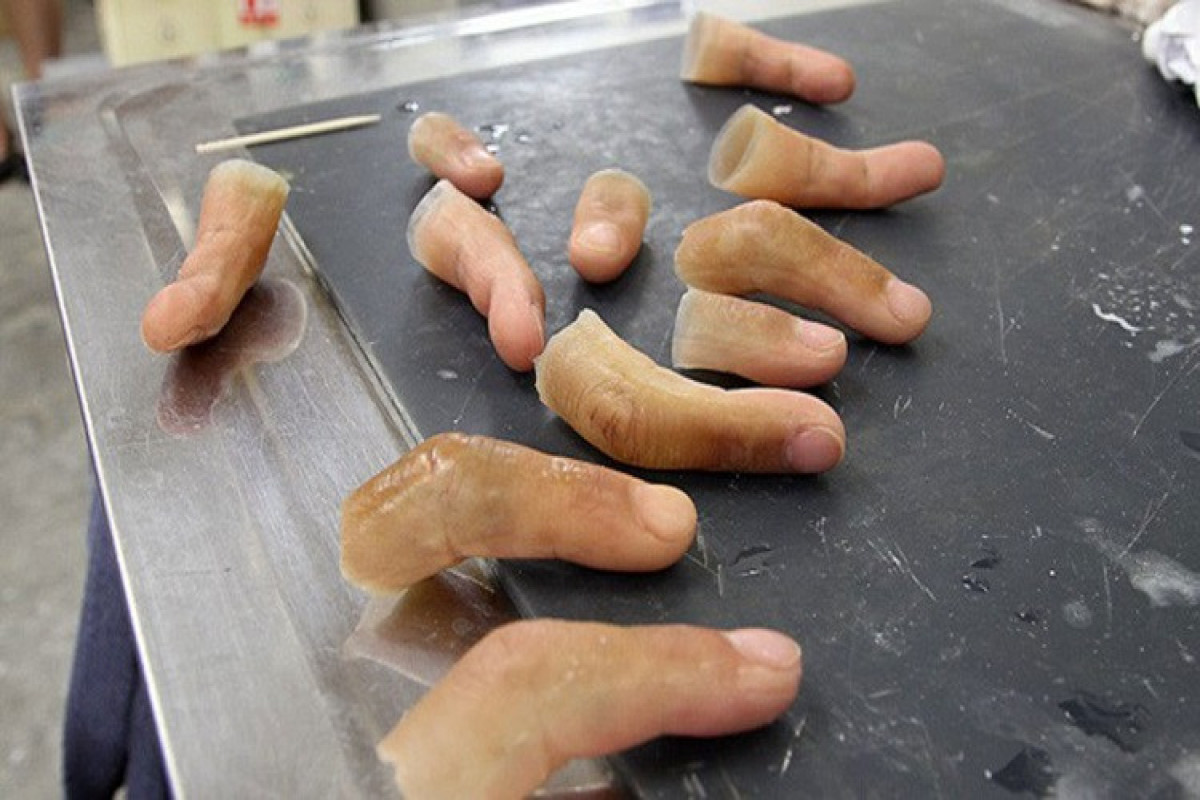 В России врачи отказались принимать мужчину с отрезанными пальцами