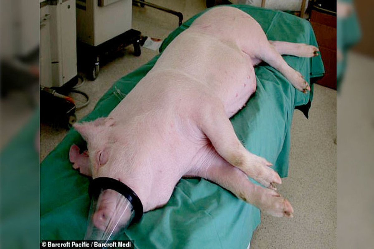 Пациенту с мертвым мозгом трансплантировали генетически модифицированное свиное сердце