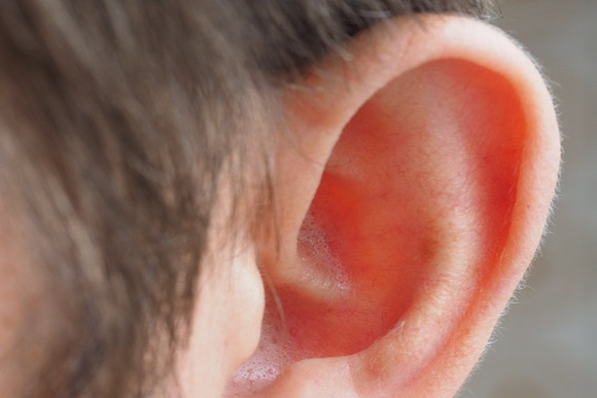 Медики США пересадили ухо, напечатанное на 3D принтере