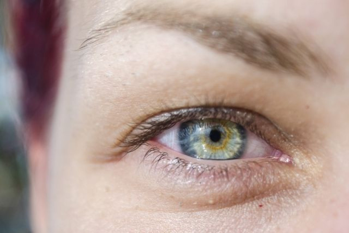 Зафиксировано новое генетическое заболевание глаз