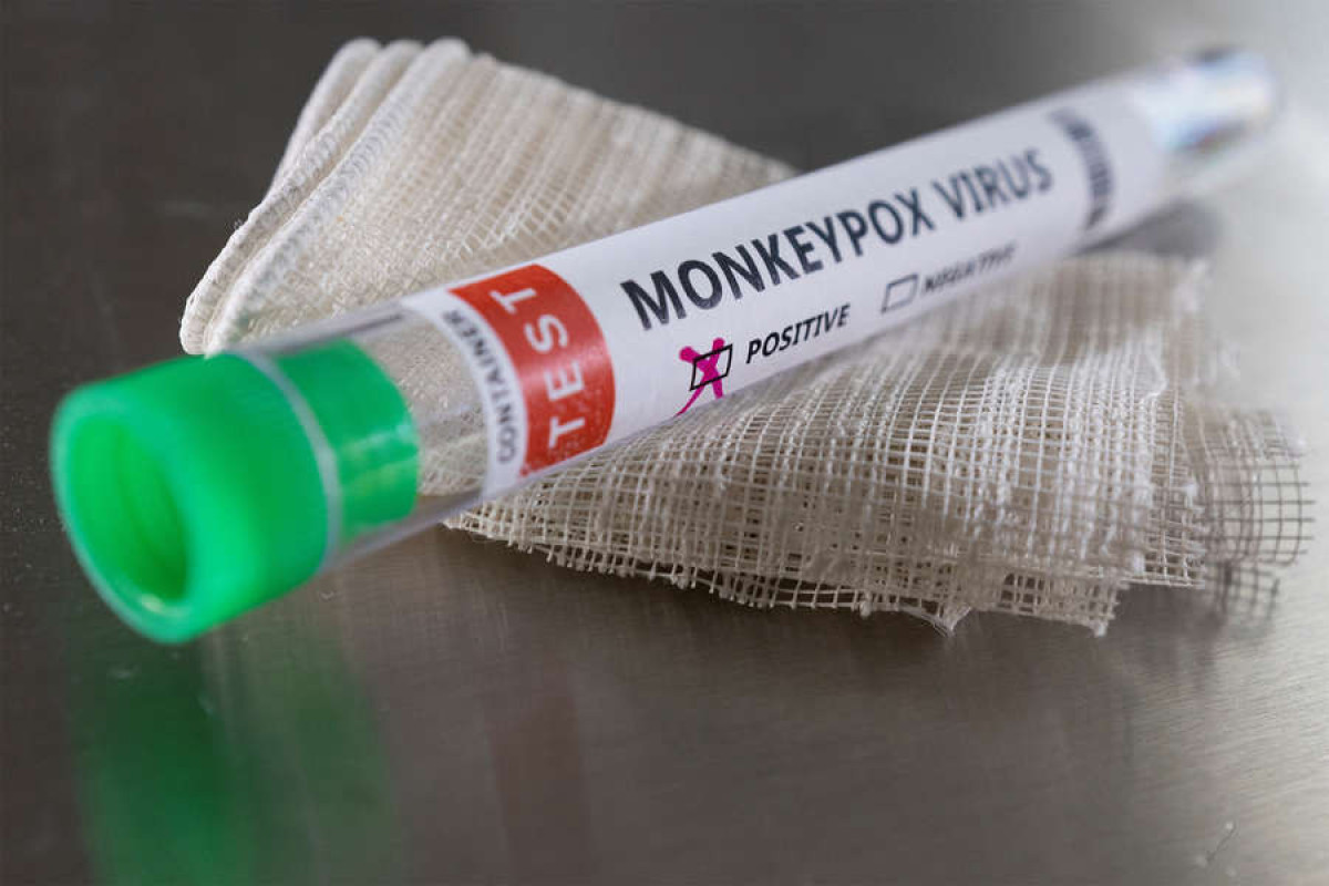 Российский эксперт выдвинул теорию об умышленном распространении оспы обезьян