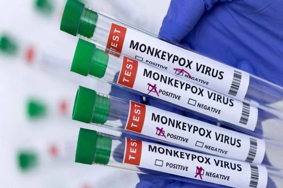 Минздрав Азербайджана запросил у ВОЗ тесты на выявление вируса оспы обезьян