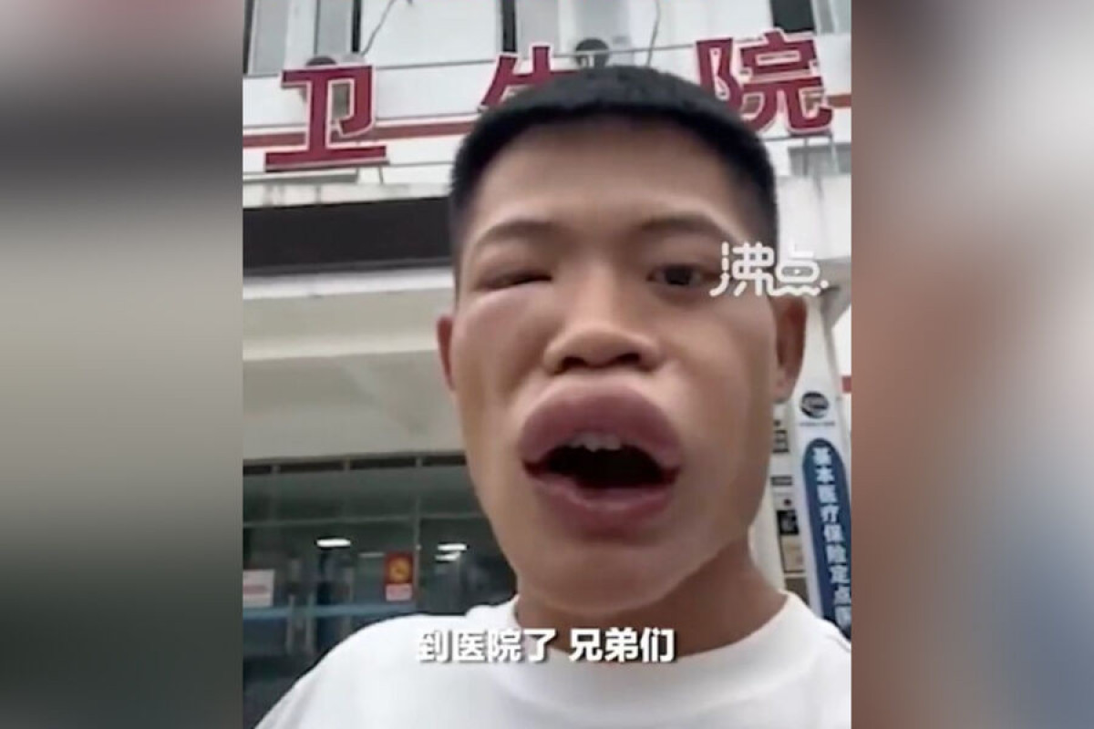 Аккаунт блогера из Китая заблокировали после того, как он съел осу на камеру