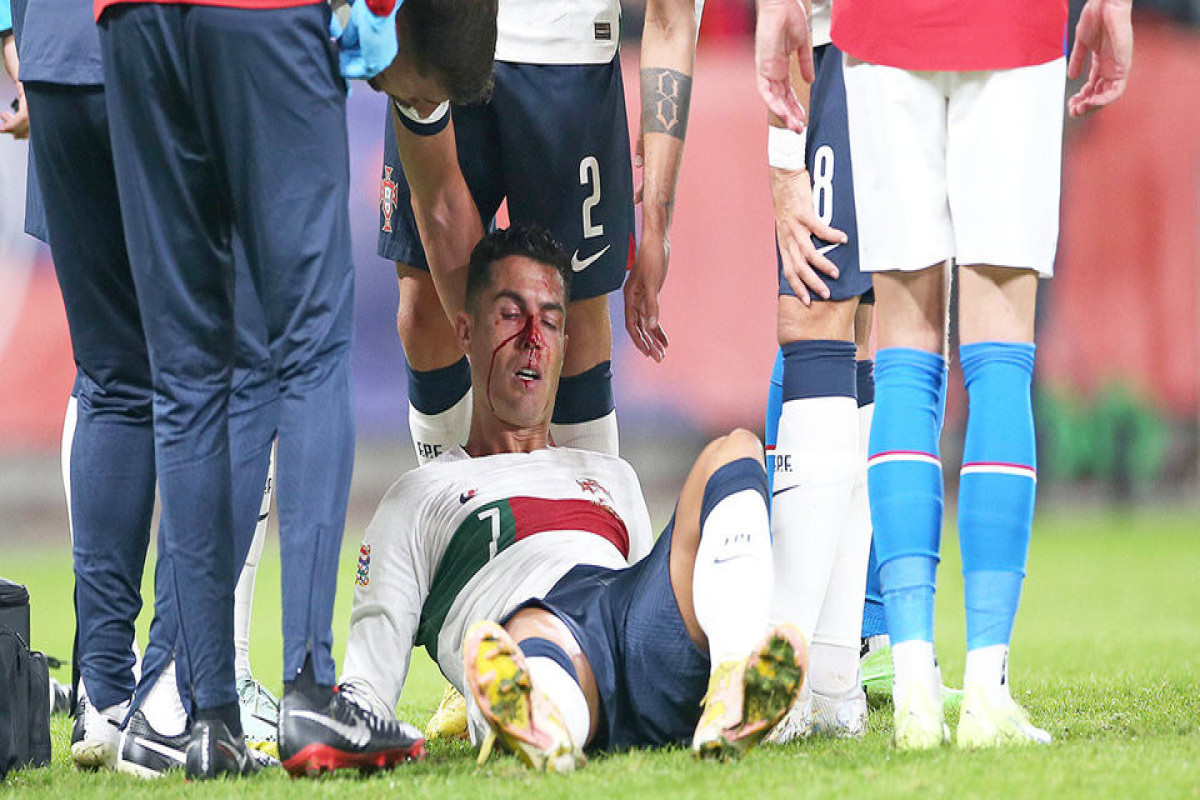 Роналду разбили нос в матче сборной Португалии с чехами-ФОТО 