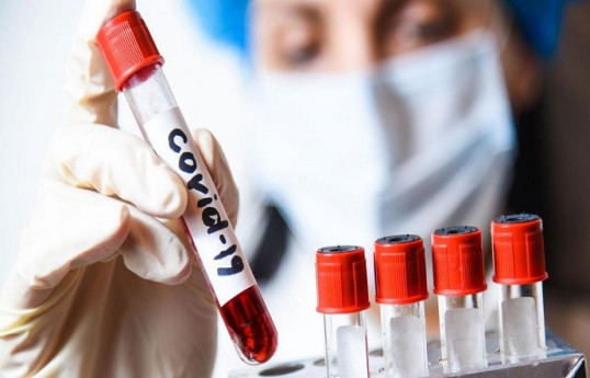 За 28 дней заболеваемость COVID-19 в мире выросла на 63% - ВОЗ 