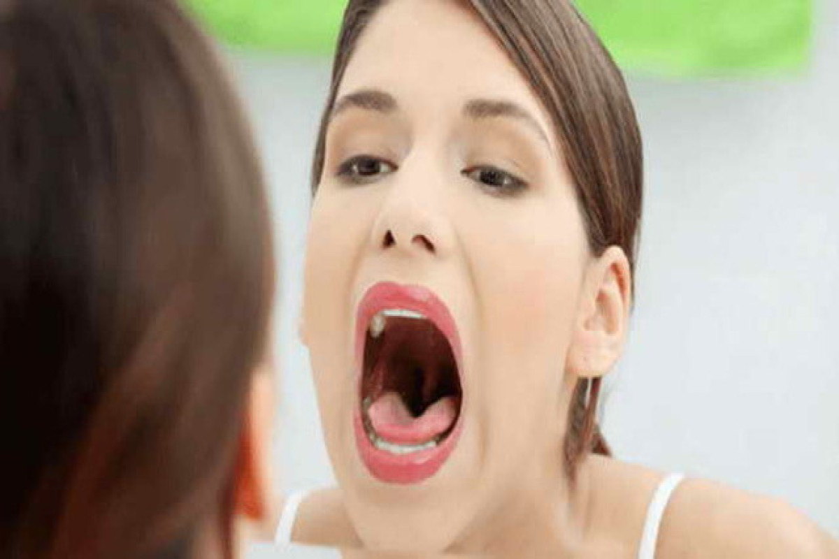 Названы причины неприятного запаха изо рта