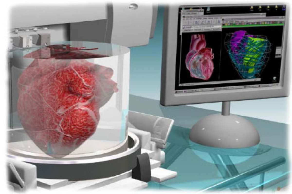 Создан робот для 3D-печати на органах внутри тела