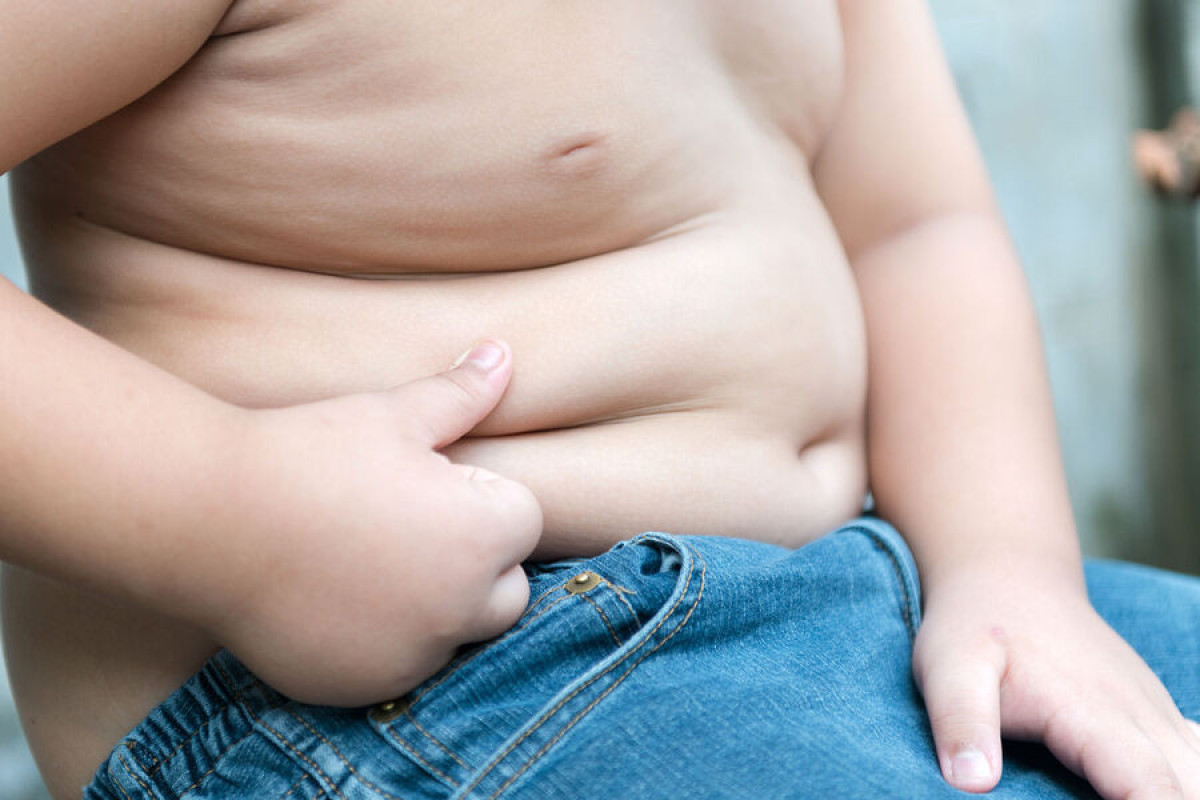 Лишний вес на 26% повышает риск гипертонии у детей