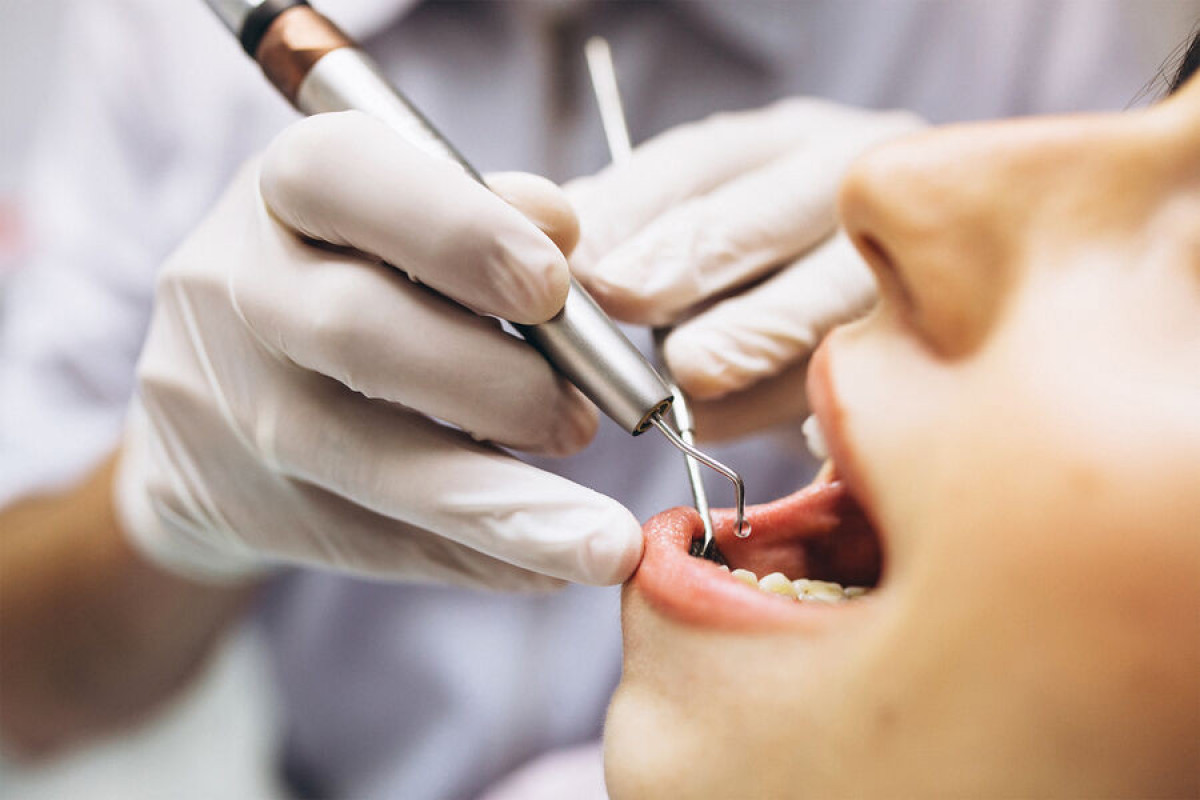 Стоматолог объяснил, чем грозит длительное отсутствие жевательных зубов
