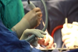 Ученые впервые пересадили человеку титановое сердце на магнитной подвеске