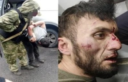 Один из террористов получил травму глаза при задержании-ФОТО 