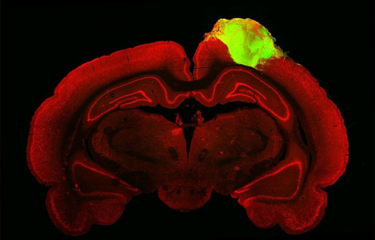 Ученые выяснили, что воспаление мозга необходимо для работы памяти