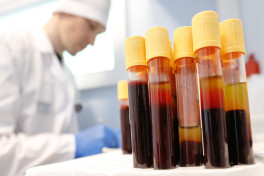 The Moscow Times: Россия сравнялась с Африкой по распространению ВИЧ 