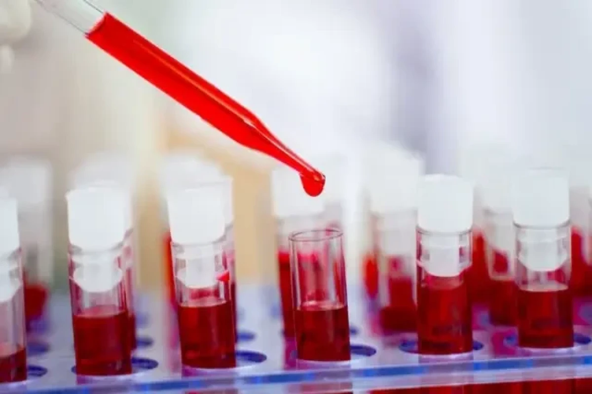 Ученые приблизились к созданию действенной вакцины от ВИЧ