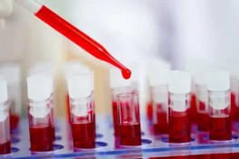 Ученые приблизились к созданию действенной вакцины от ВИЧ
