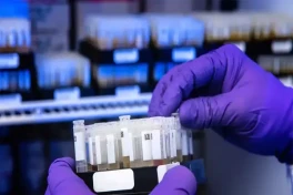 В штате Вашингтон подтвержден редкий случай заражения вирусом H5N5