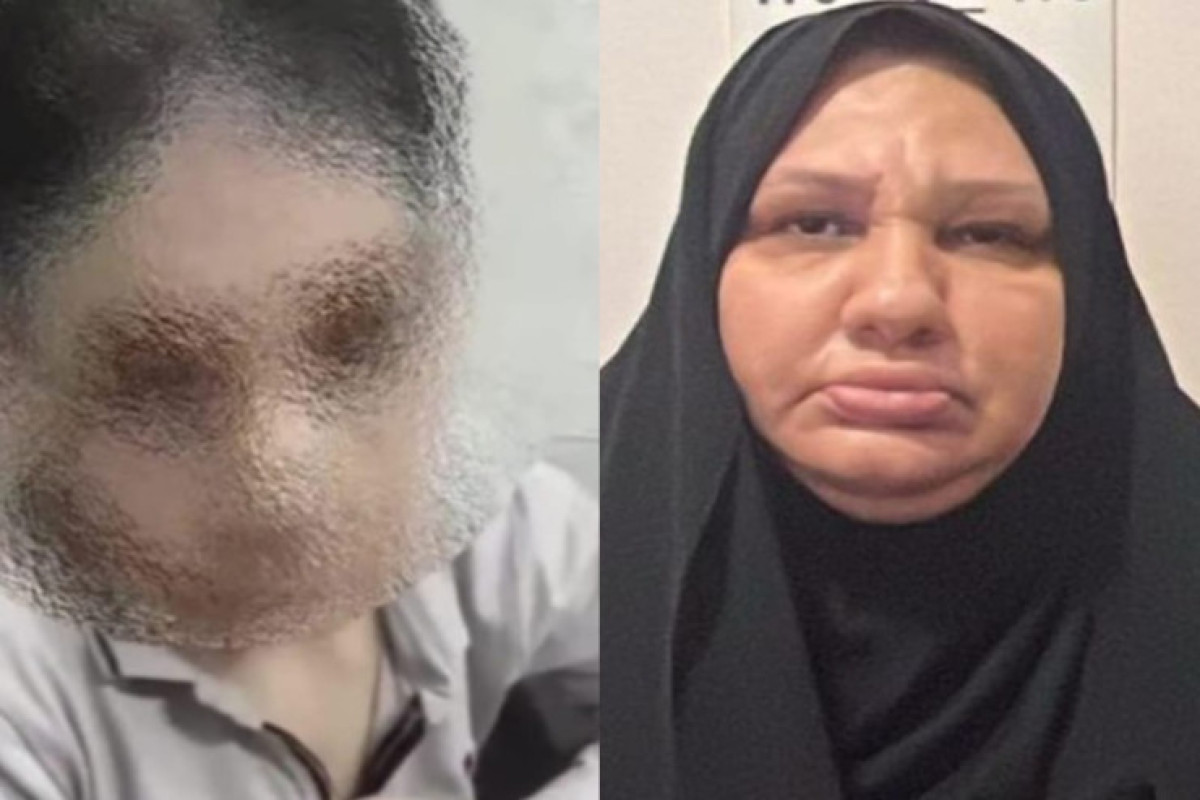 В Баку арестована женщина, издевавшаяся над 14-летним племянником