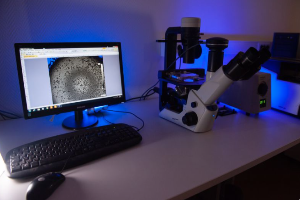 До 50% людей под угрозой: бактерия повышает риск рака