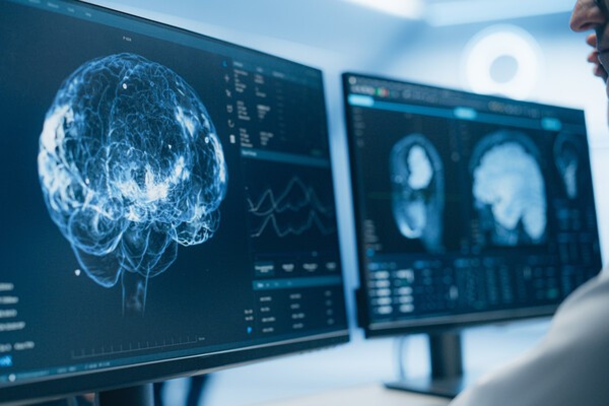 Ученые нашли новую причину гипертонии