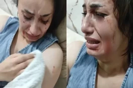 В Баку рассматривают дело о жестоком нападении