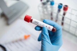 В Душанбе задержали подозреваемых в намеренном заражении людей ВИЧ