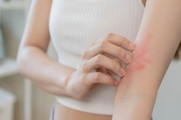 Холод как угроза: редкая аллергия может быть смертельно опасной