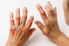 Новый нейроимплант снижает воспаление при артрите