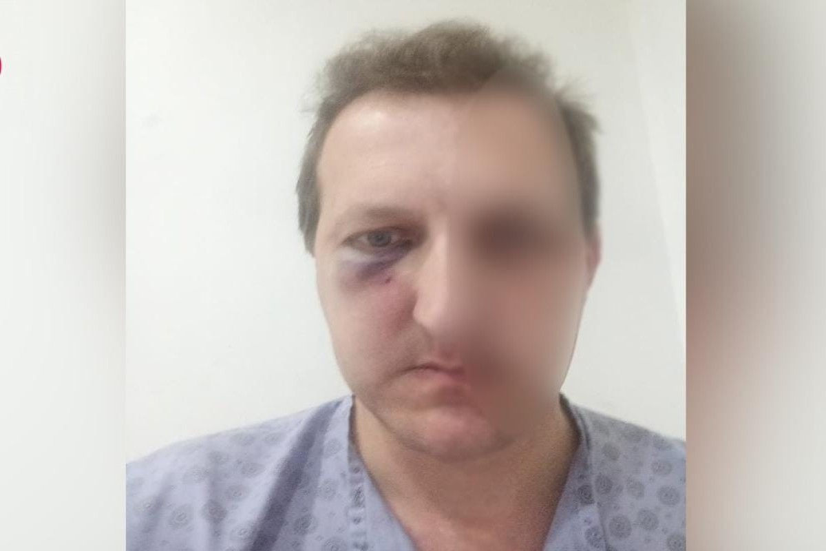 Сын известных азербайджанских артистов стал жертвой нападения в Баку