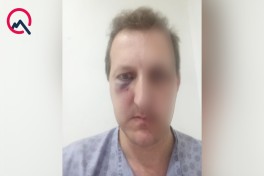 Сын известных азербайджанских артистов стал жертвой нападения в Баку